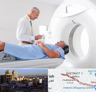 سی تی اسکن در فرمانیه 