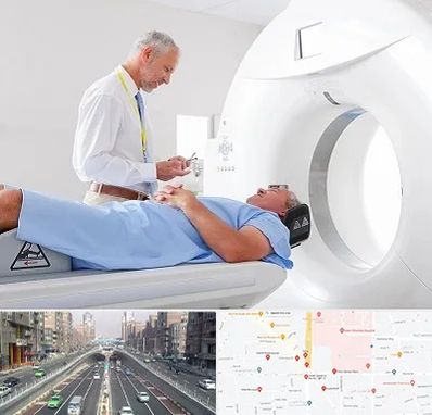 سی تی اسکن در توحید