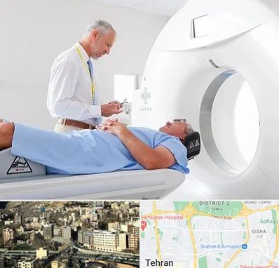 سی تی اسکن در مرزداران 