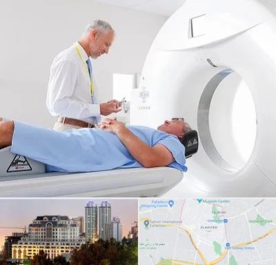 سی تی اسکن در فرشته 