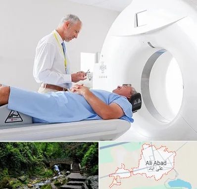 سی تی اسکن در علی آباد کتول