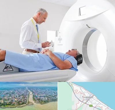 سی تی اسکن در تنکابن