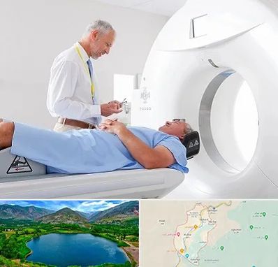 سی تی اسکن در رودبار