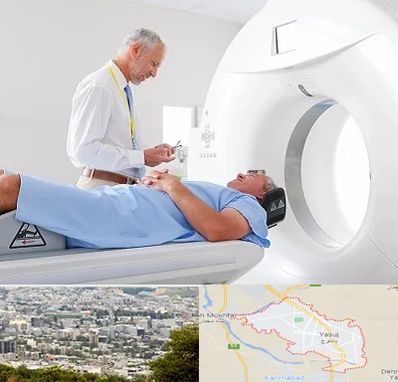 سی تی اسکن در یاسوج