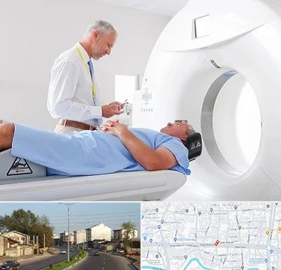 سی تی اسکن در ضیابری رشت