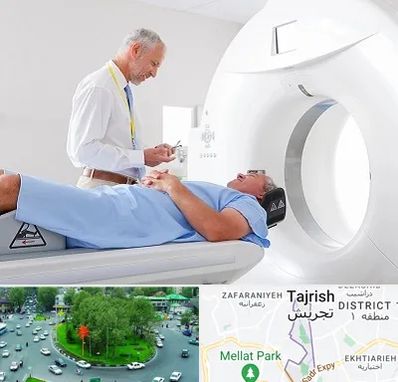 سی تی اسکن در تجریش 