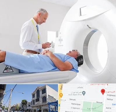 سی تی اسکن در افسریه 