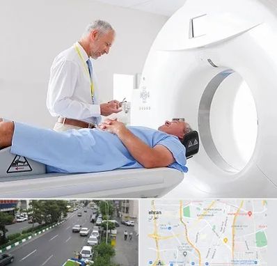 سی تی اسکن در ستارخان 