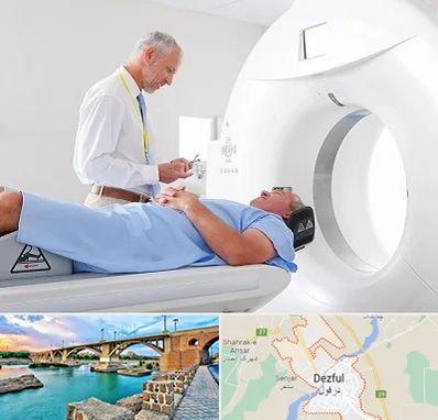 سی تی اسکن در دزفول