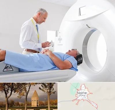 سی تی اسکن در تویسرکان