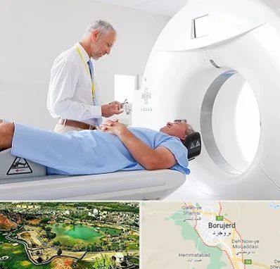 سی تی اسکن در بروجرد