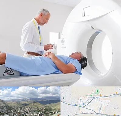 سی تی اسکن در رودهن