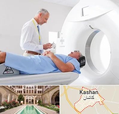 سی تی اسکن در کاشان