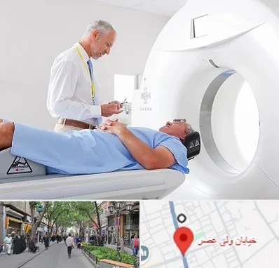 سی تی اسکن در ولیعصر شهریار