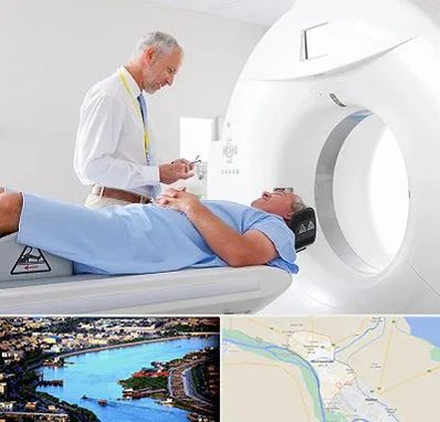 سی تی اسکن در خرمشهر