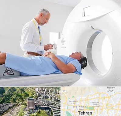 سی تی اسکن در شمال تهران 