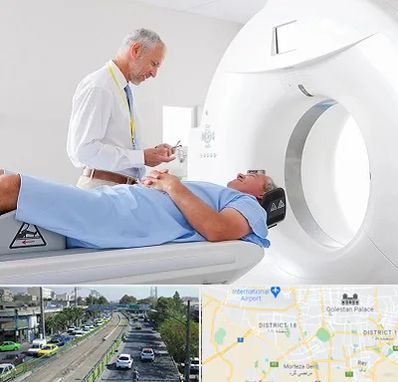 سی تی اسکن در جنوب تهران 