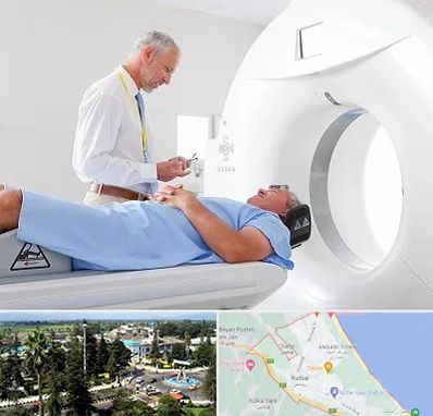 سی تی اسکن در رودسر