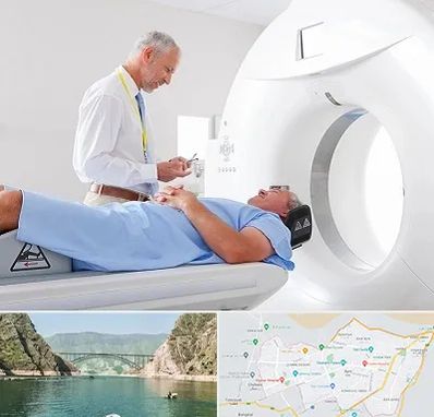 سی تی اسکن در ایلام