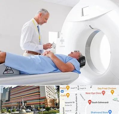 سی تی اسکن در سهروردی 