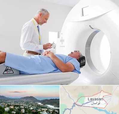 سی تی اسکن در لواسان