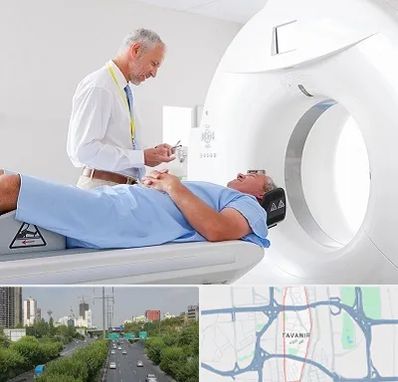 سی تی اسکن در توانیر