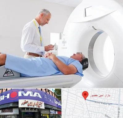 سی تی اسکن در امین حضور