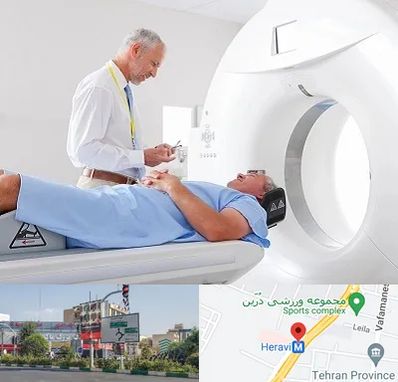 سی تی اسکن در هروی 
