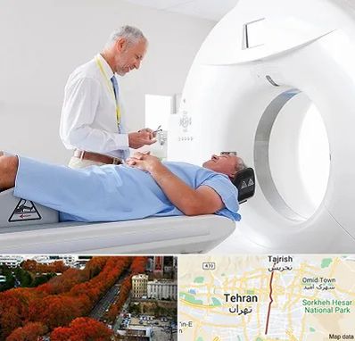 سی تی اسکن در ولیعصر 