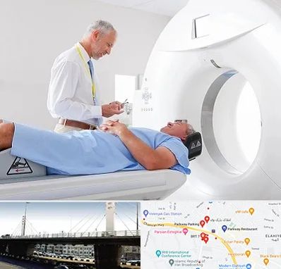 سی تی اسکن در پارک وی 