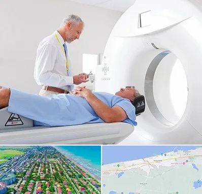 سی تی اسکن در فریدونکنار