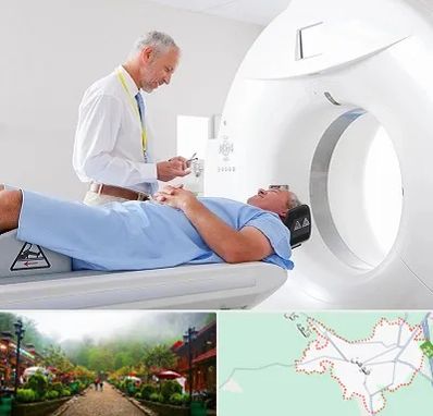 سی تی اسکن در فومن