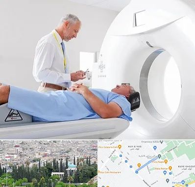 سی تی اسکن در محلاتی شیراز