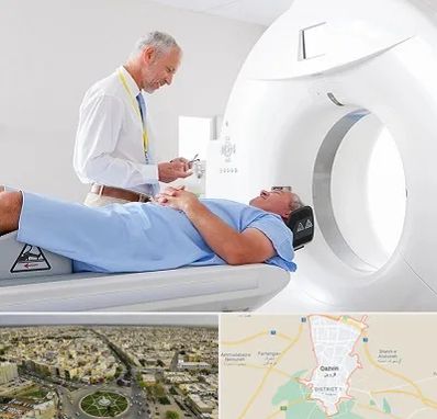 سی تی اسکن در قزوین