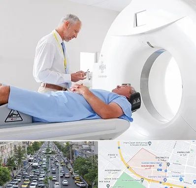 سی تی اسکن در گلشهر کرج