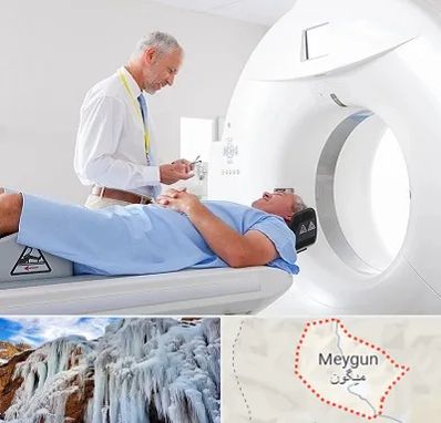سی تی اسکن در میگون