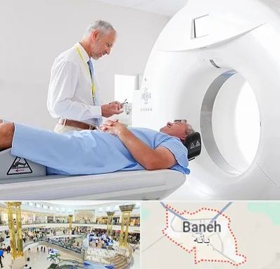 سی تی اسکن در بانه