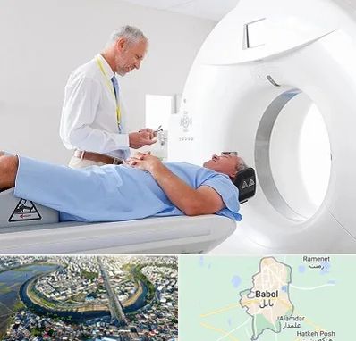 سی تی اسکن در بابل