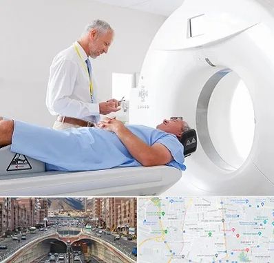 سی تی اسکن در منطقه 10 تهران