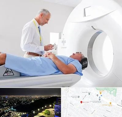 سی تی اسکن در هفت تیر مشهد