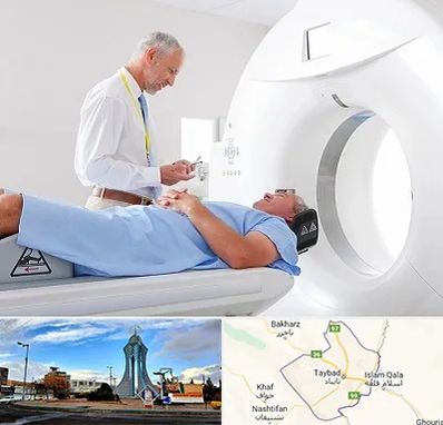 سی تی اسکن در تایباد