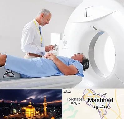 سی تی اسکن در مشهد