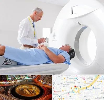 سی تی اسکن در میدان ولیعصر