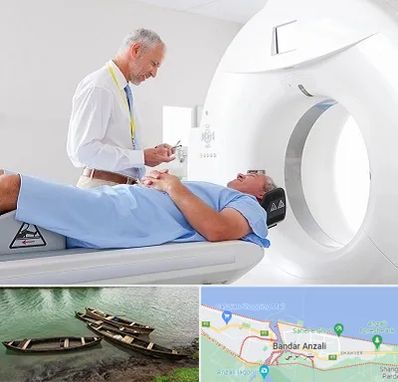 سی تی اسکن در بندر انزلی