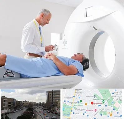 سی تی اسکن در بلوار فردوسی مشهد