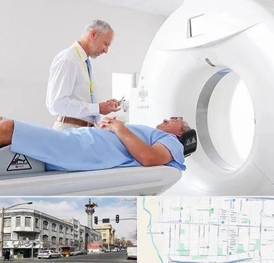 سی تی اسکن در 17شهریور