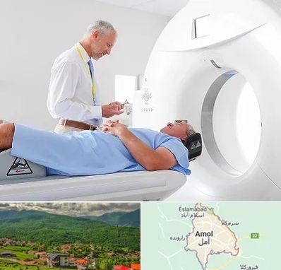 سی تی اسکن در آمل