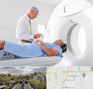 سی تی اسکن در یوسف آباد 