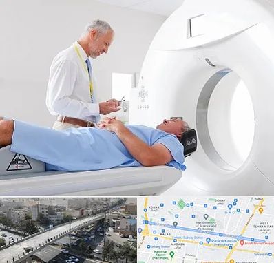 سی تی اسکن در فرجام