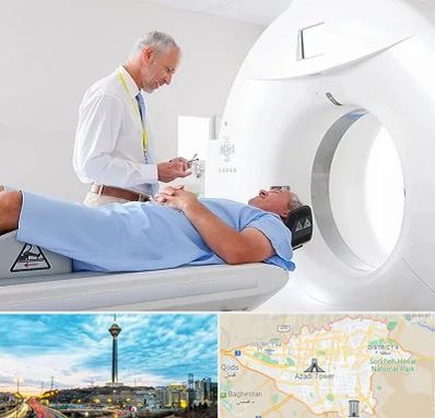 سی تی اسکن در تهران